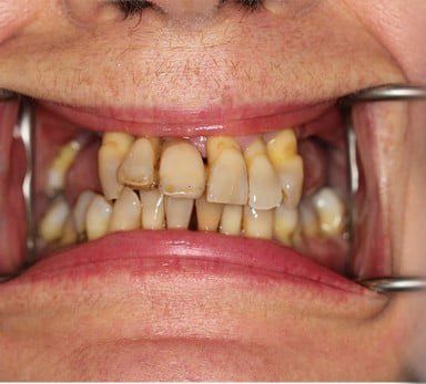 Broad Lane Dental