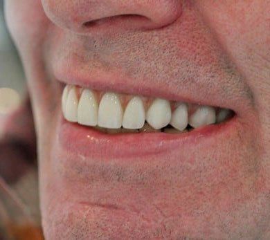 Broad Lane Dental