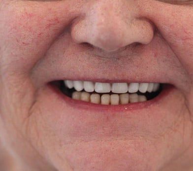 Broad Lane Dental