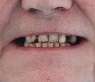 Broad Lane Dental