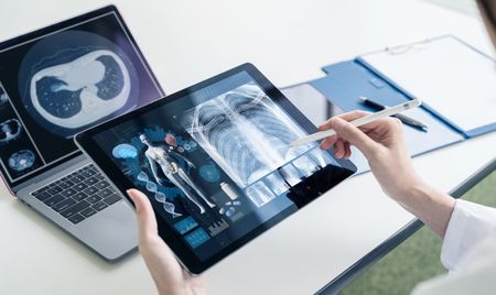 A person is holding a tablet with a pen in front of a laptop.