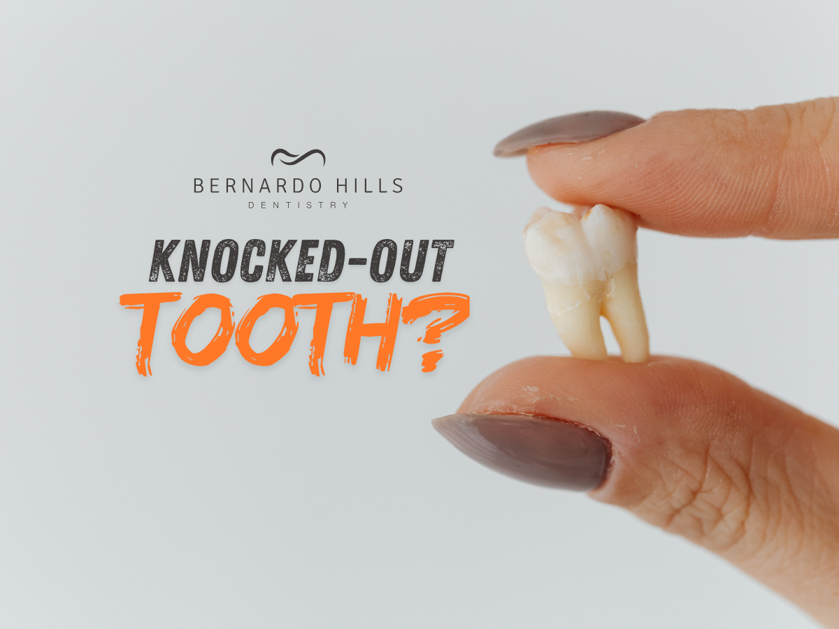 Knocked-Out Tooth? Rancho Bernardo Emergency Dentists Share What to Do Next