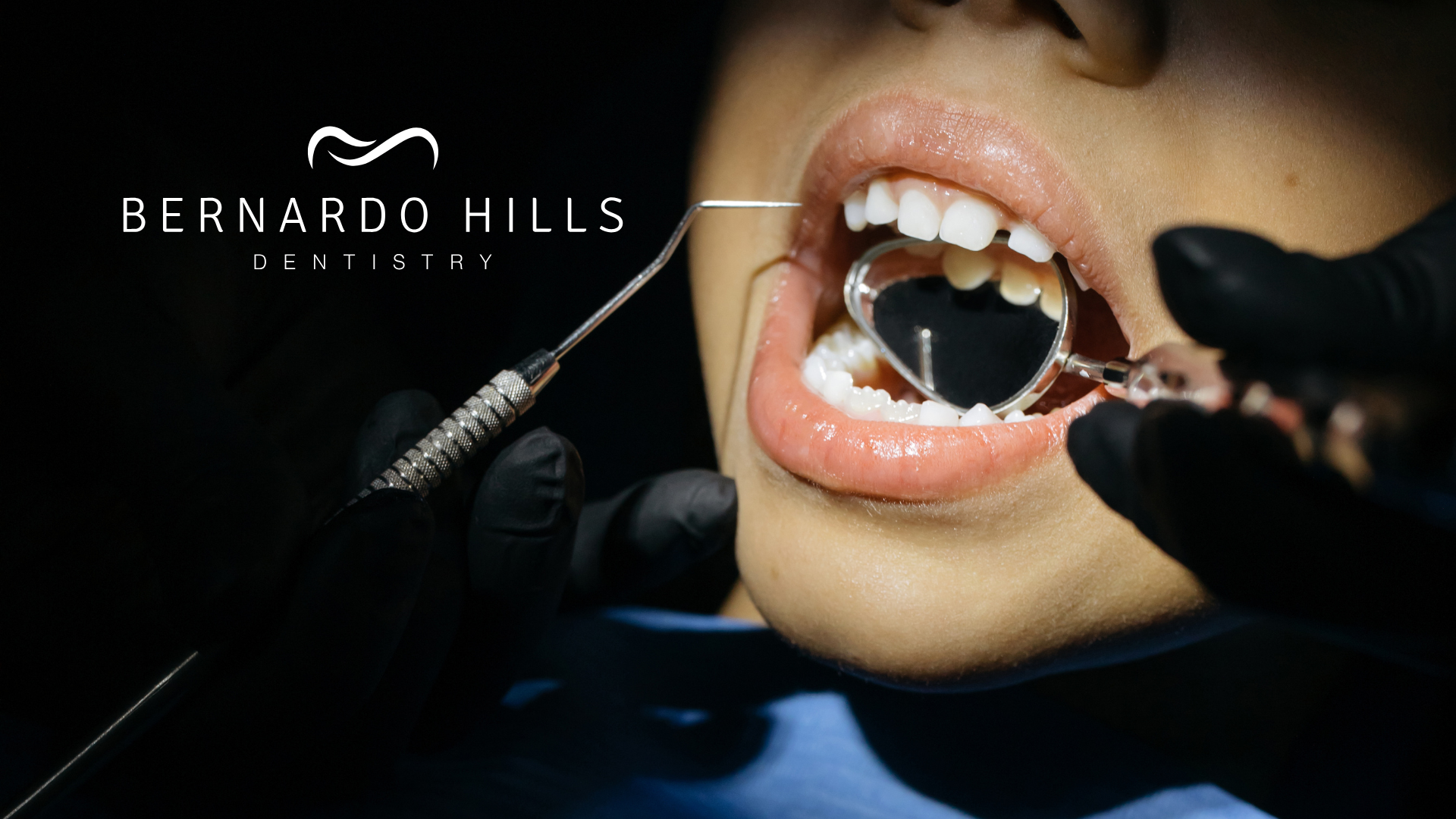 The Importance of Regular Dental Checkups in Rancho Bernardo