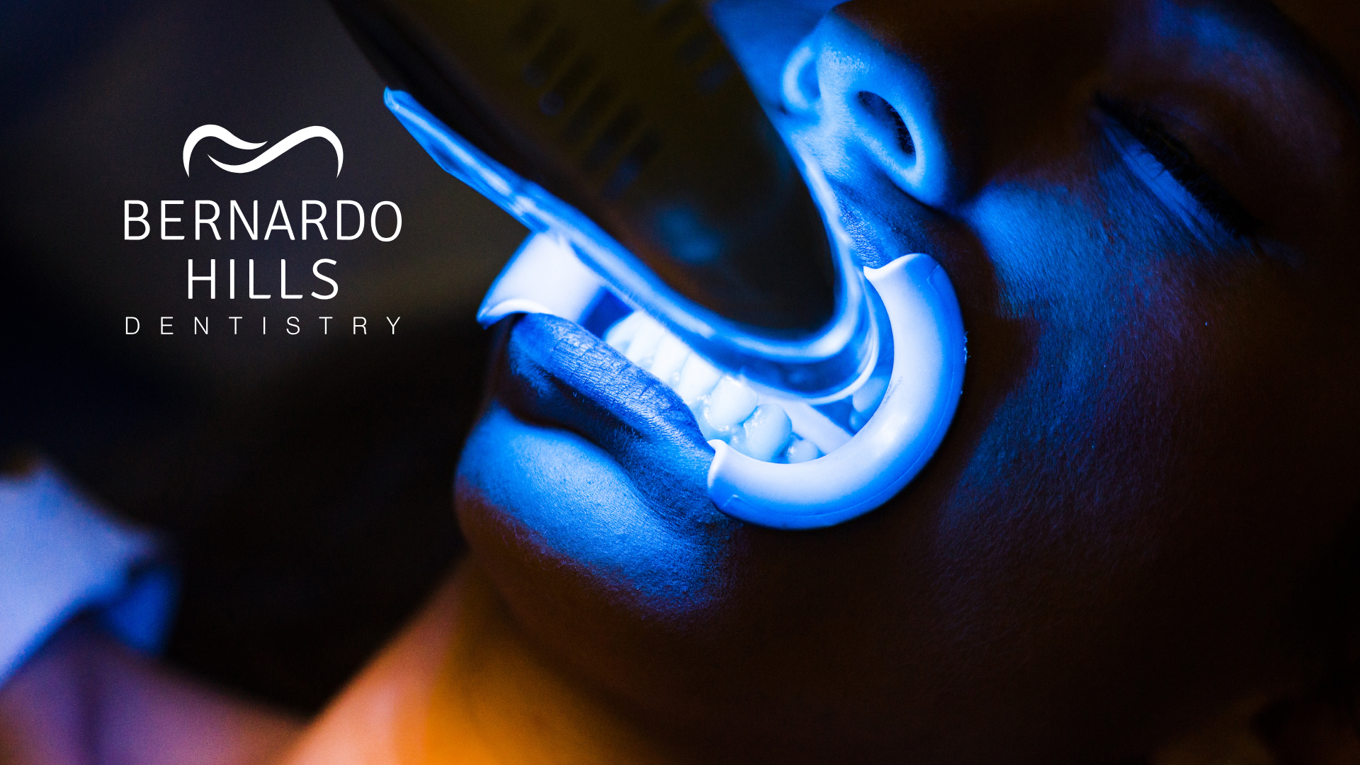 The Do’s and Don’ts of Teeth Whitening: Tips from Rancho Bernardo Dentists