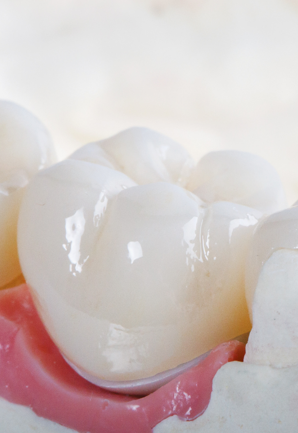 A before and after photo of a woman 's teeth.