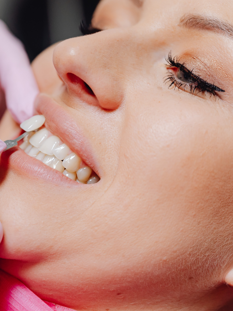 A woman is getting her teeth examined by a dentist.