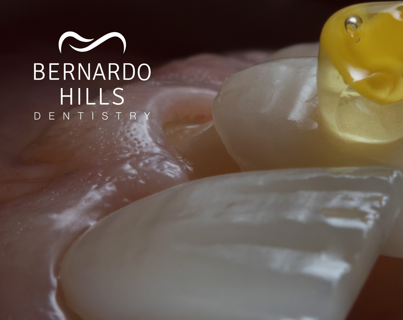 A bernardo hills dentistry logo is on a tooth