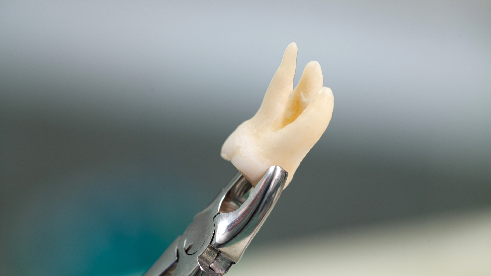 What Happens to the Abscess after tooth extraction