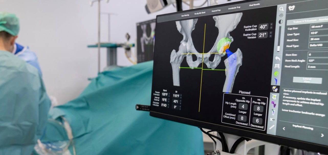 Surgical options for hip injuries Baton Rouge