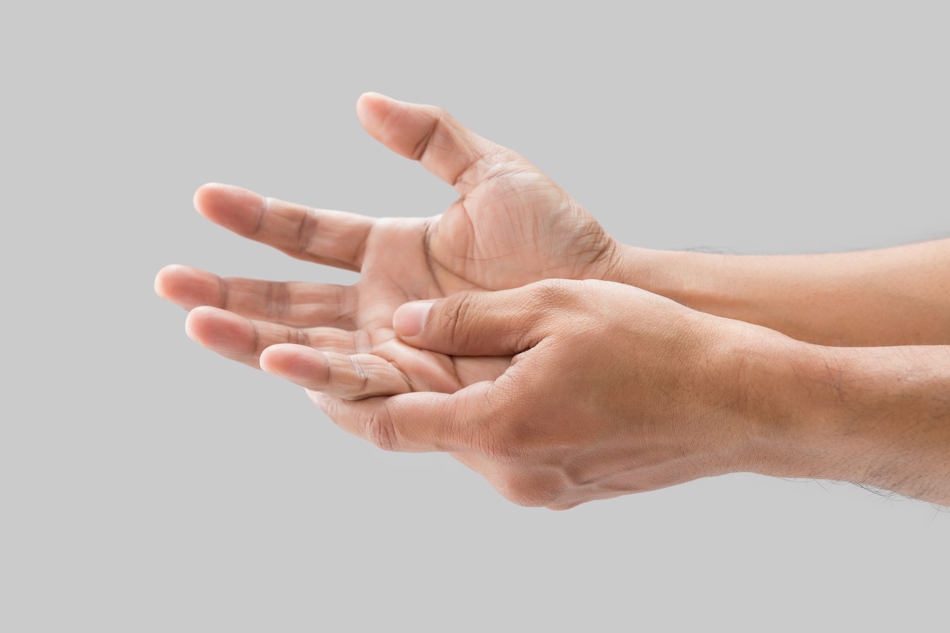 Long-term Effects of Cubital Tunnel Syndrome on Hand Function