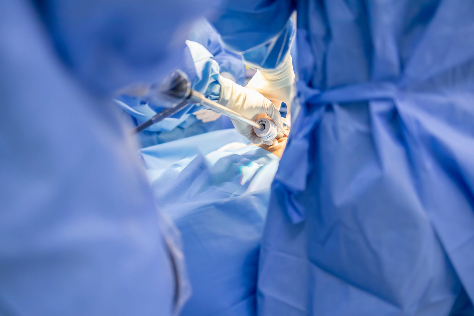 The Benefits of Minimally Invasive Surgery