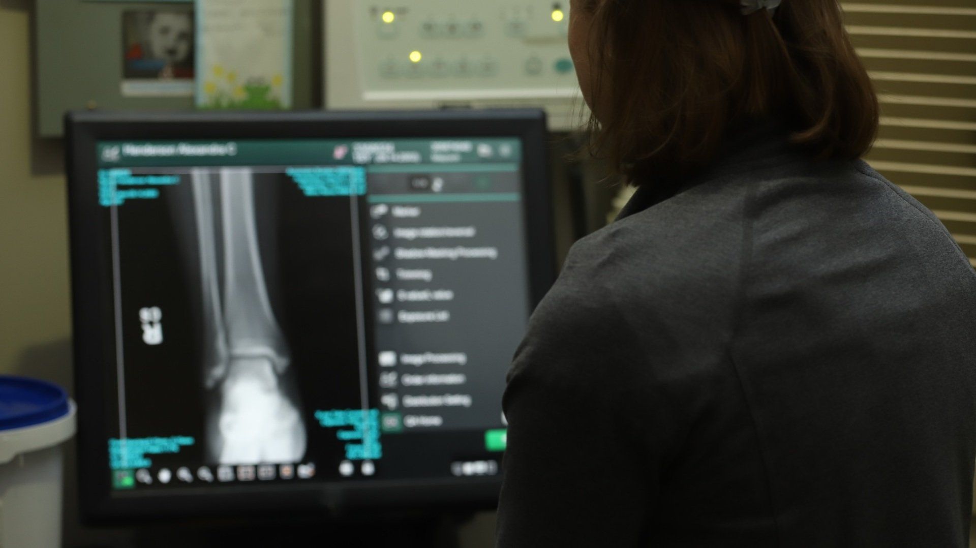 Orthopedic Imaging Baton Rouge Xray and MRI Services Baton Rouge