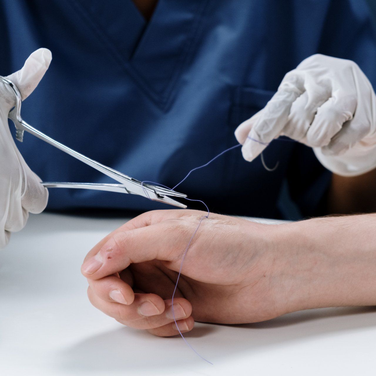 A person is getting stitches on their wrist with scissors