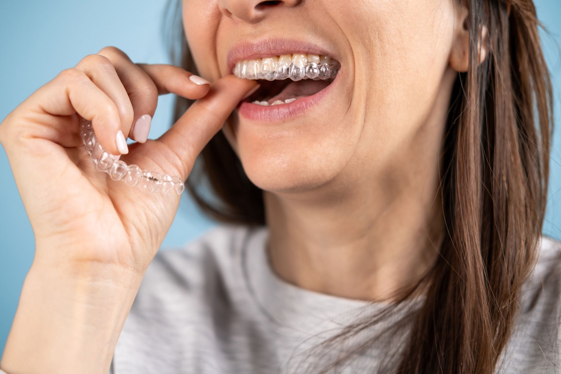 Woman inserting clear aligner into mouth. Blue background.