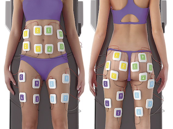 TruSculpt® tecnologia per addominali scolpiti