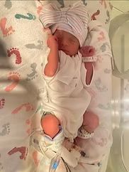 Newborn baby wearing a hat and jumpsuit, lying in a hospital bed with foot-shaped prints.