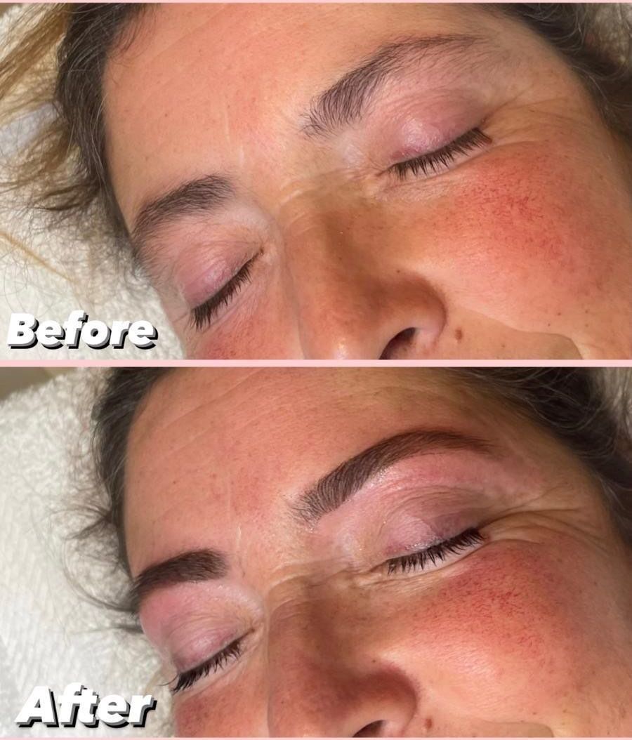 Before en after van