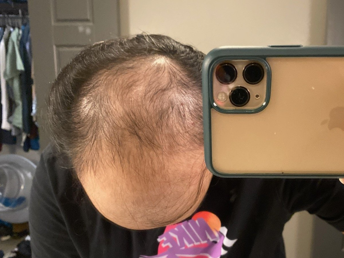 A man is taking a picture of his head with a cell phone.