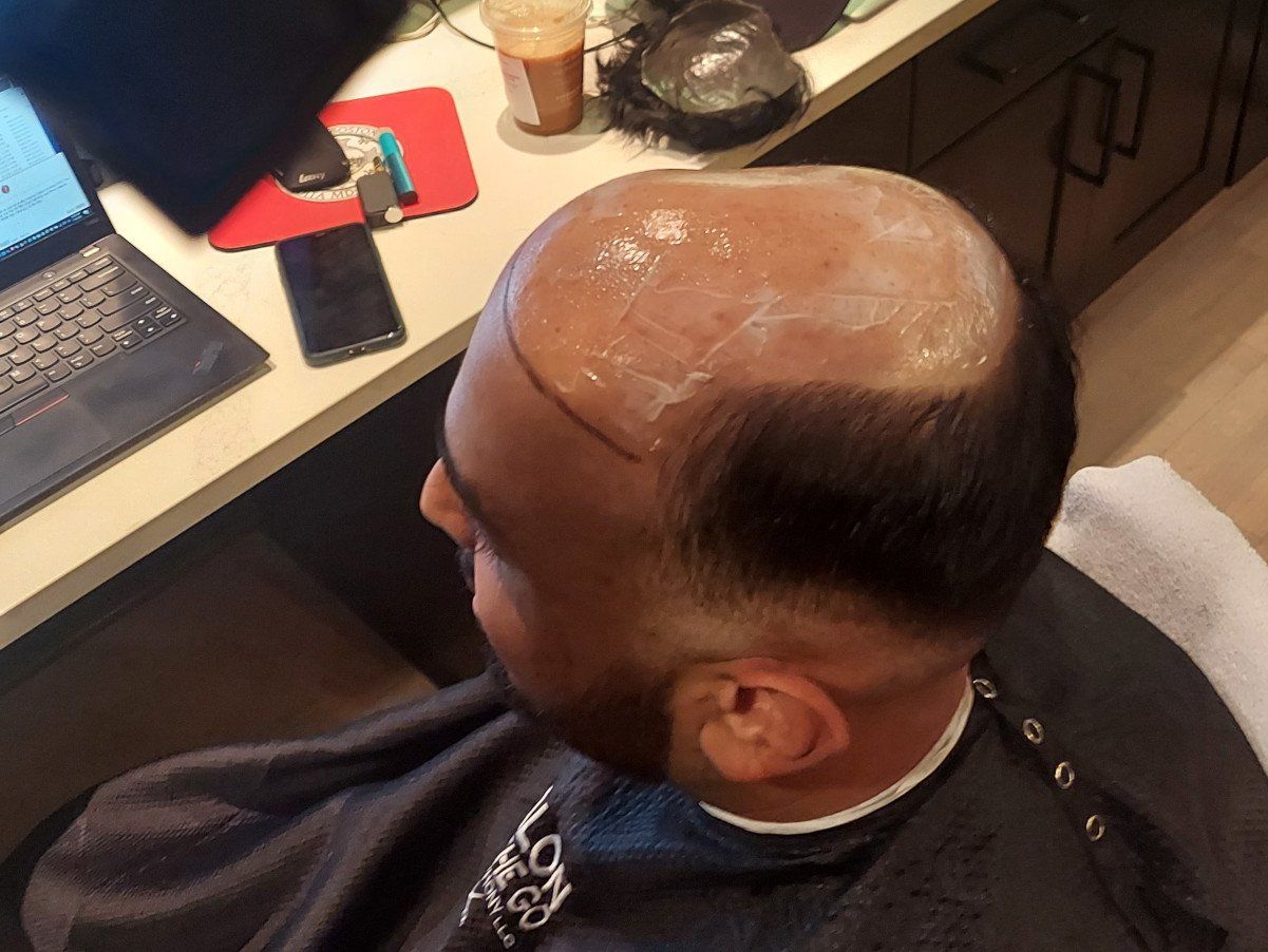 A man with a bald head is getting his hair cut