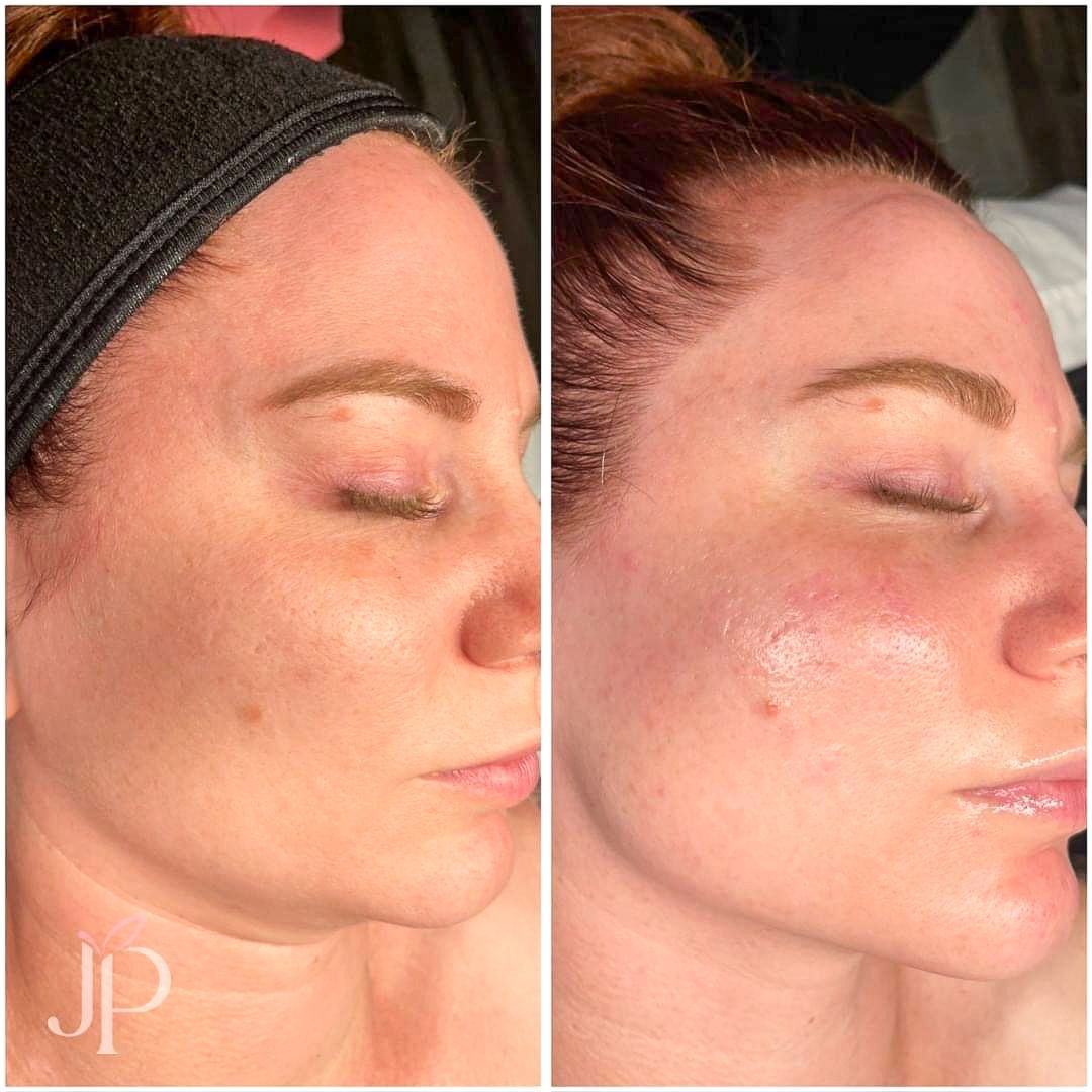 A before and after photo of a woman 's face with her eyes closed.