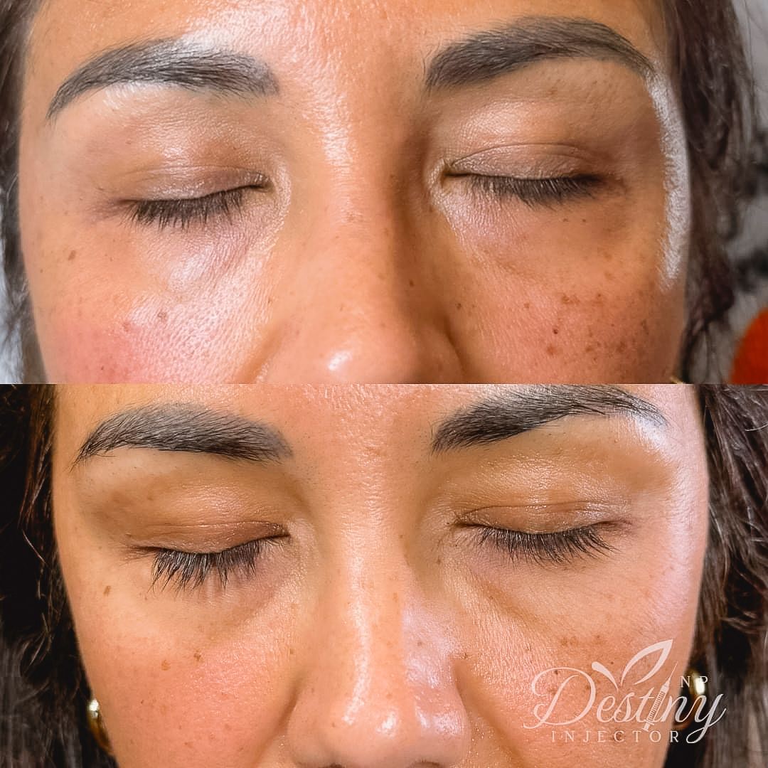A before and after photo of a woman 's face with her eyes closed.