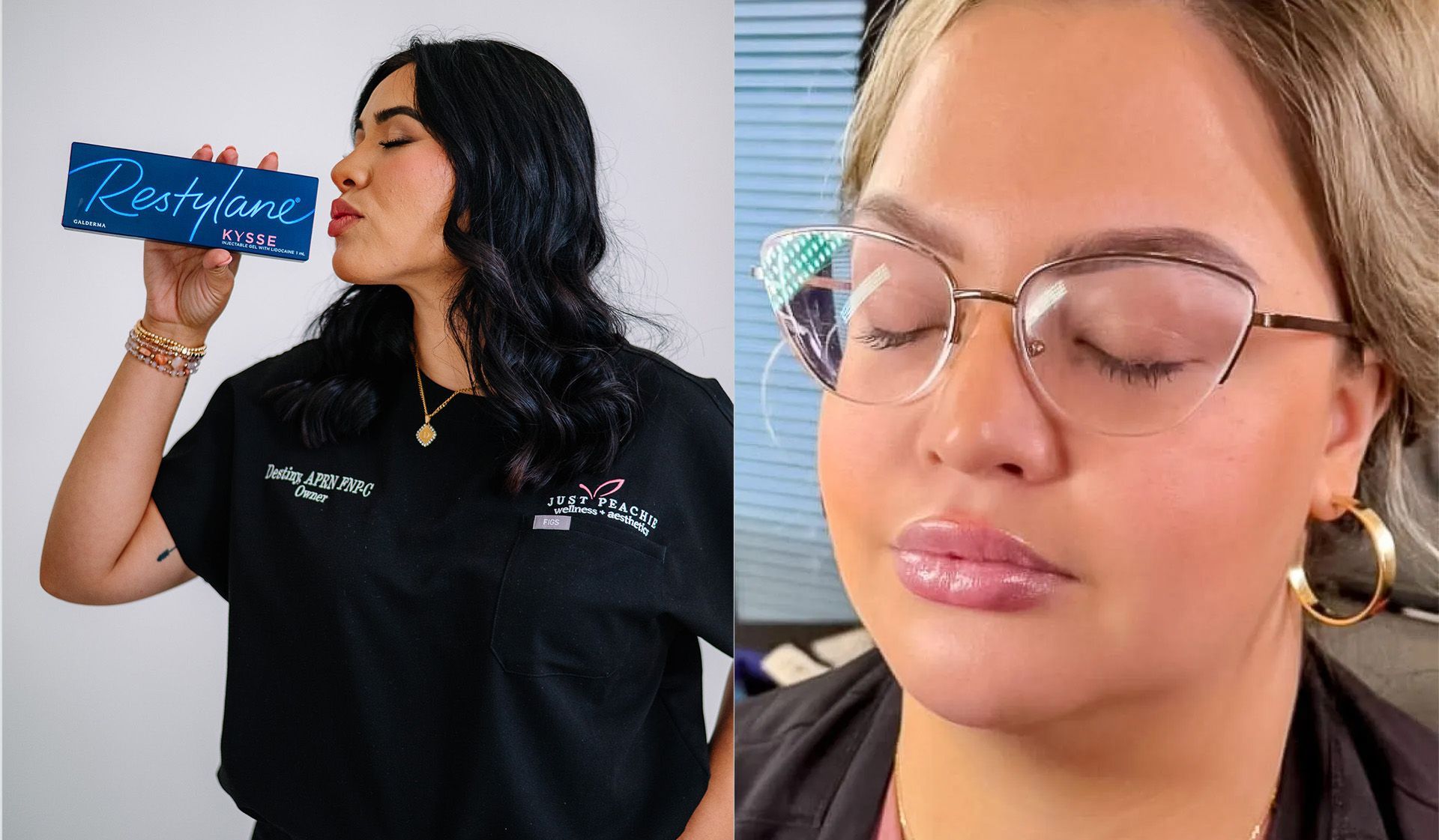 Two women: One holding filler, one with full lips.