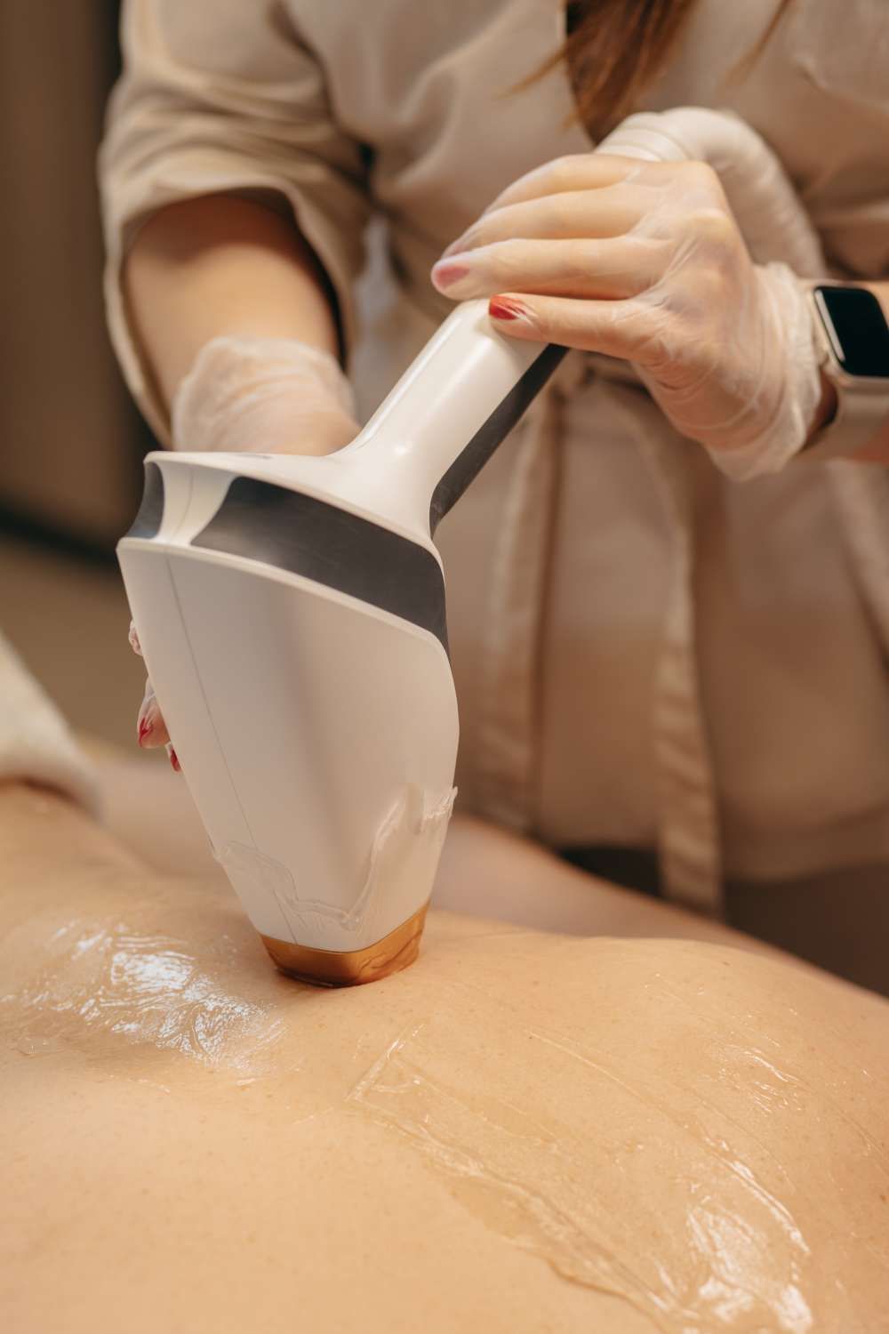 Person receiving laser hair removal treatment on back with a handheld device.