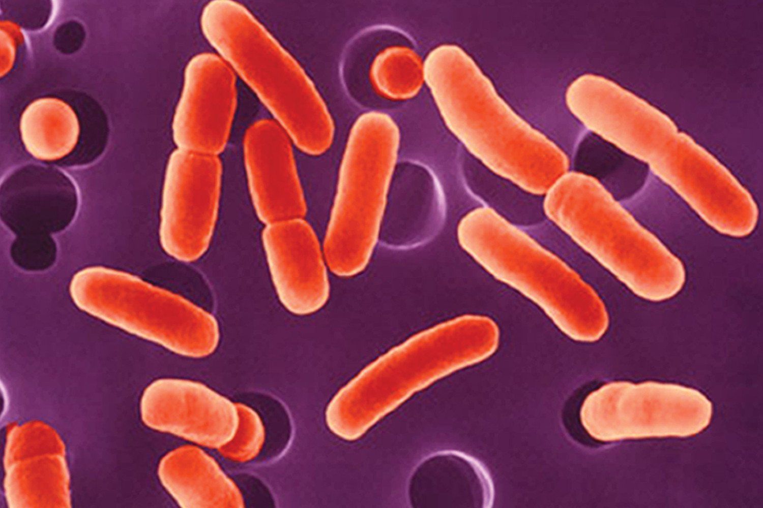 E-Coli — Orlando, FL — Florida Pure Water Solutions