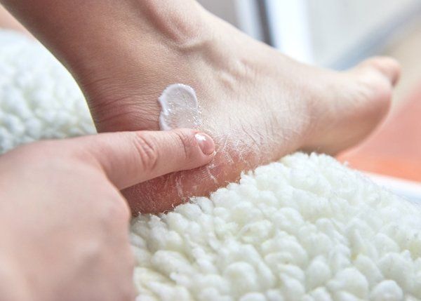 Skin Conditions — Cream Dry Feet Covered with Cracks in Lake Zurich,  IL