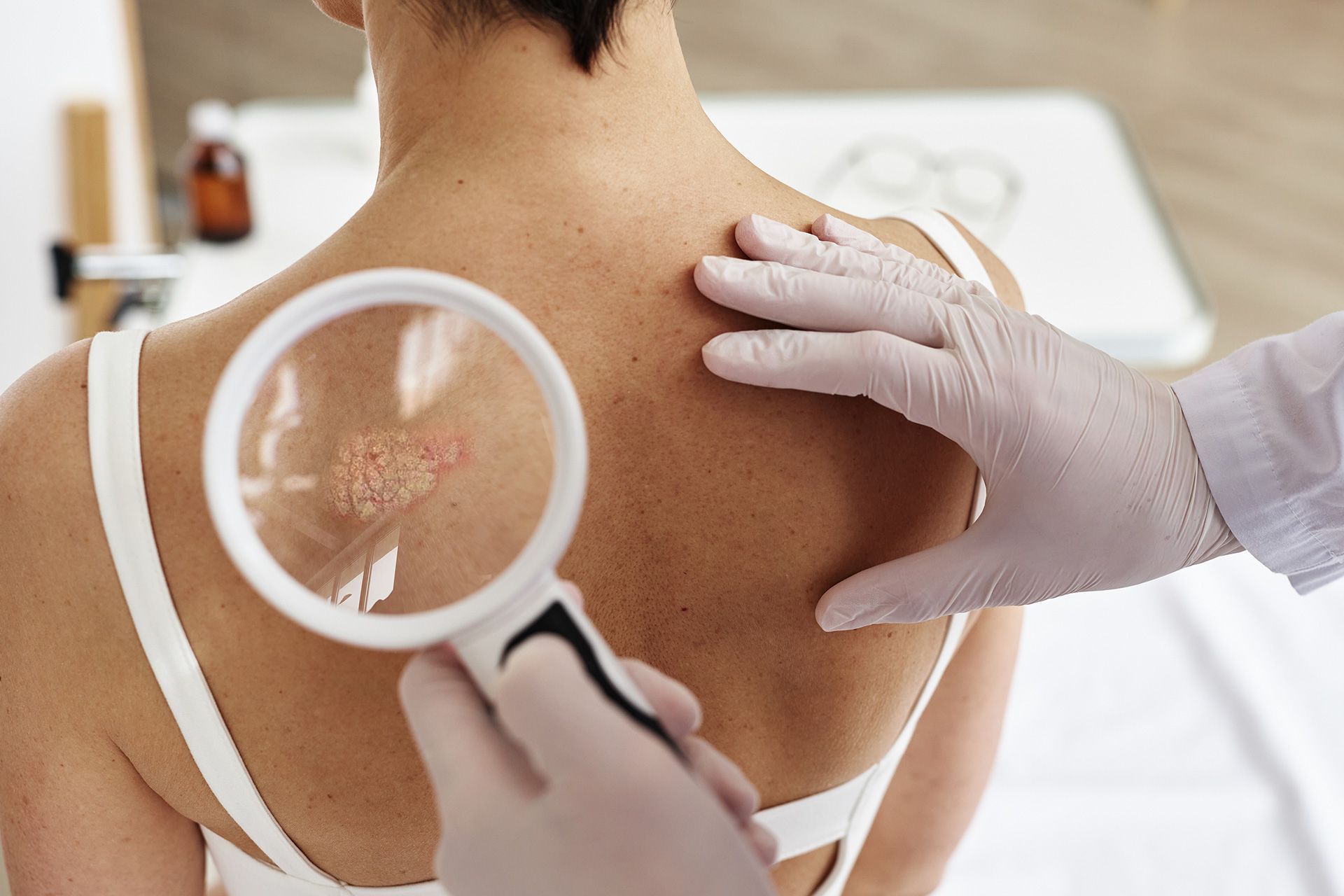 Skin cancer misdiagnosis examination by doctor
