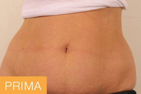 trattamenti corpo - prima