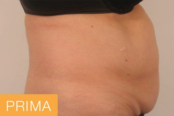 trattamenti corpo - prima