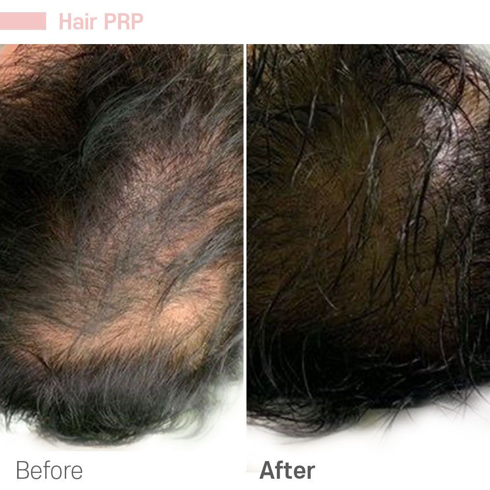 A before and after photo of a person 's hair.