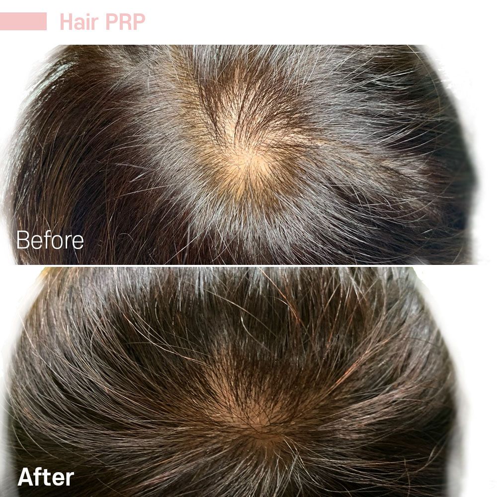 A before and after picture of a person 's hair.