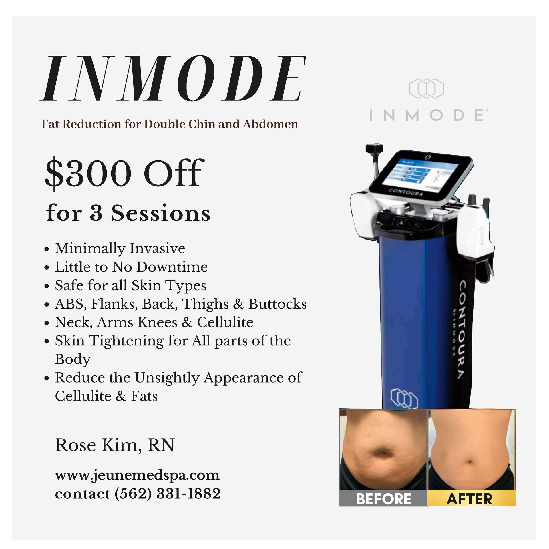 An advertisement for inmode offers $ 300 off for 3 sessions