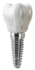 A 3d rendering of a dental implant in the shape of a tooth.