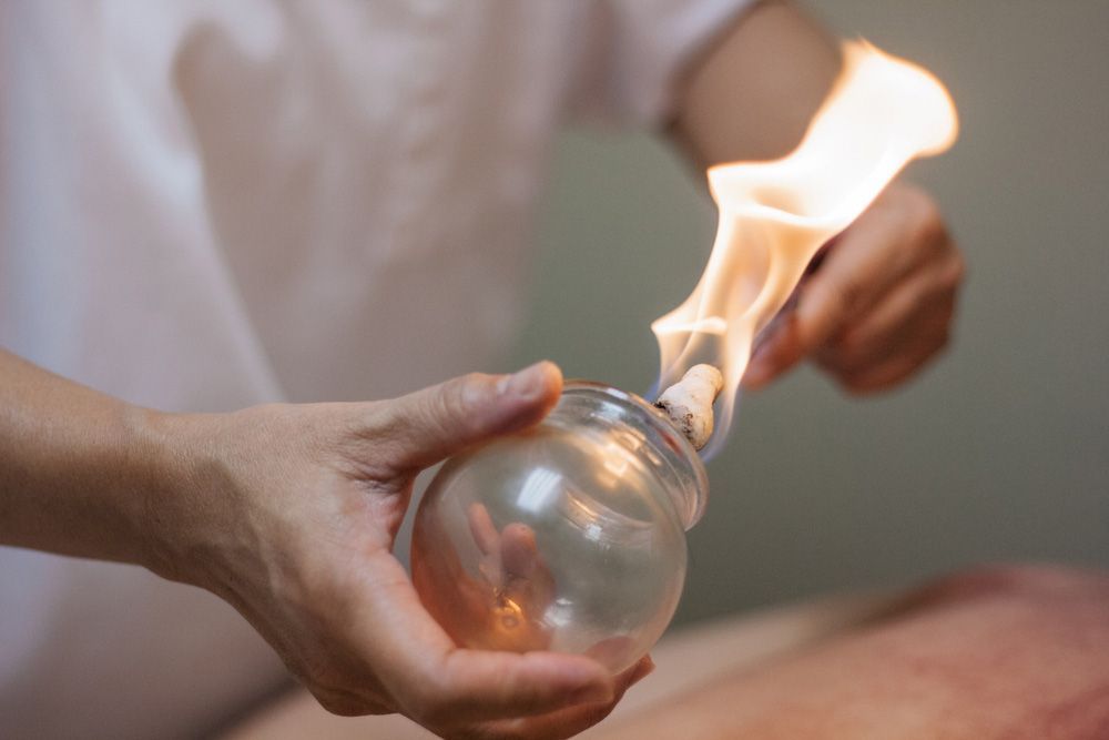 Woman Preparing Glass Cup With Fire For Cupping Therapy — Chinese Cupping in Glenfield Park, NSW