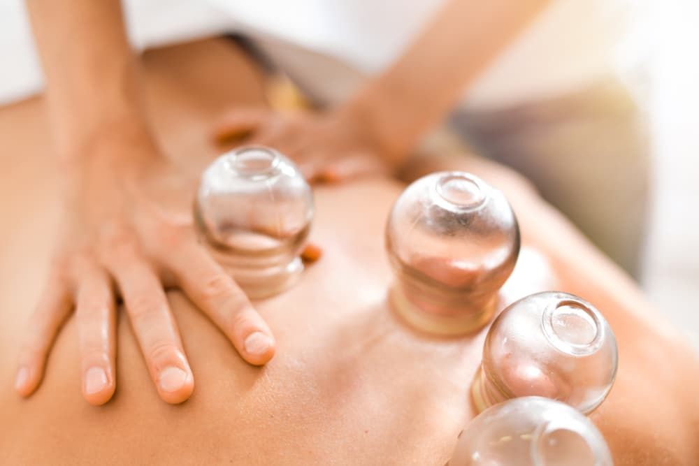 A Person is Getting a Cupping Treatment on Their Back — Master Your Journey in Glenfield Park, NSW