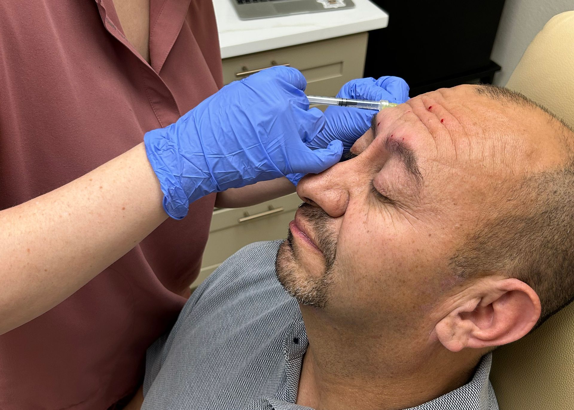 Injectable and PDO Thread Treatment in Seabrook and League City