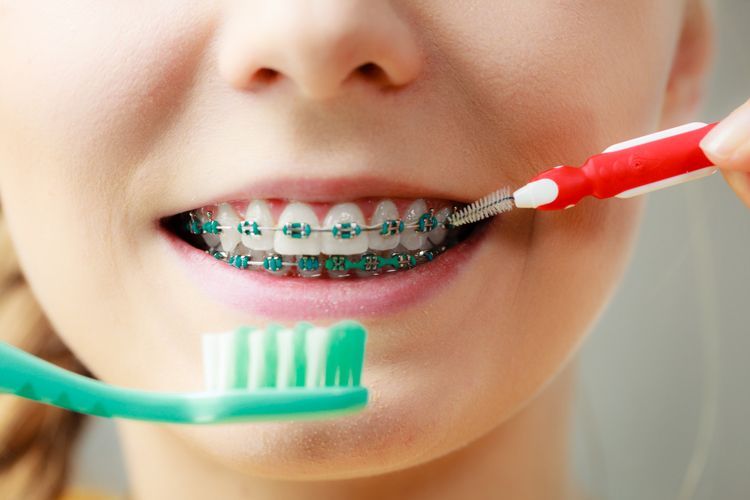 Brushing Teeth With Braces — Leeton, NSW — Leeton Orthodontics