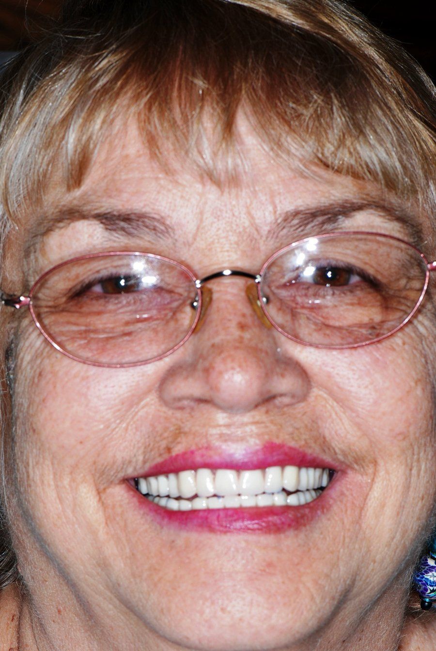 Dentures — Woman Smiling With Her New Dentures in Tucson, AZ
