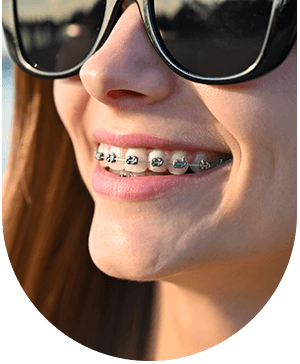 Close-up of woman smiling with braces, showcasing benefits of general orthodontics at Hampstead Clinic