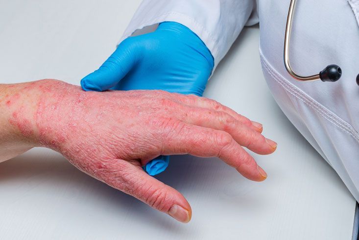 CLINICA DE LESIONES DERMICAS PROMEDICA  -  CORTADAS