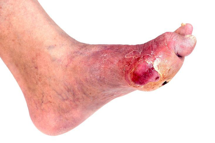 CLINICA DE LESIONES DERMICAS PROMEDICA  -  ULCERAS