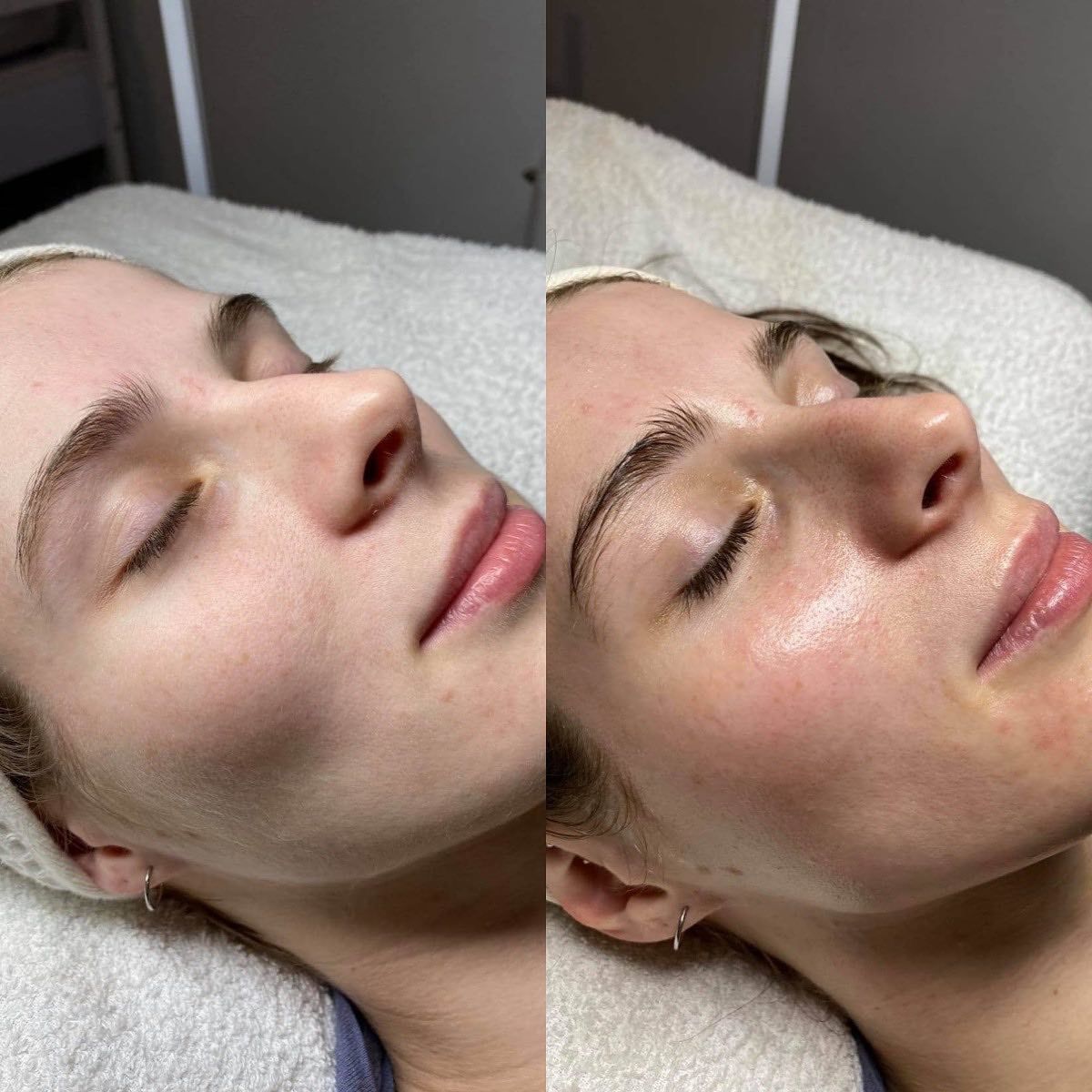 A Woman Is Laying On A Bed With Her Eyes Closed — Vanity Skin and Beauty Forster in Forster, NSW