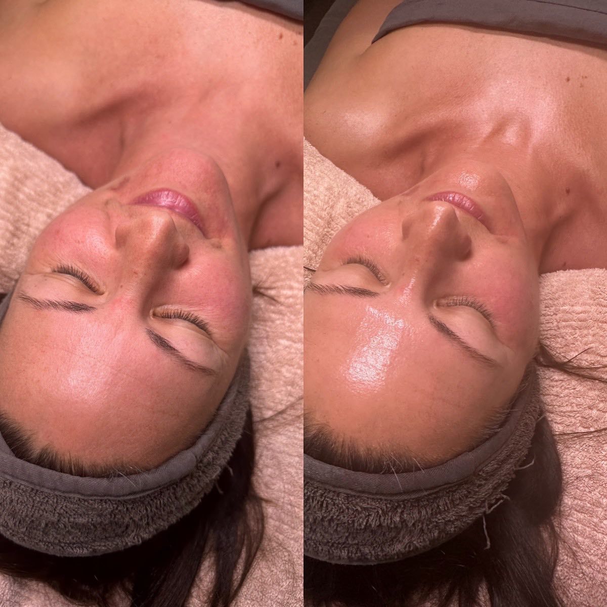 A Woman Is Laying On A Bed With Her Eyes Closed — Vanity Skin and Beauty Forster in Forster, NSW