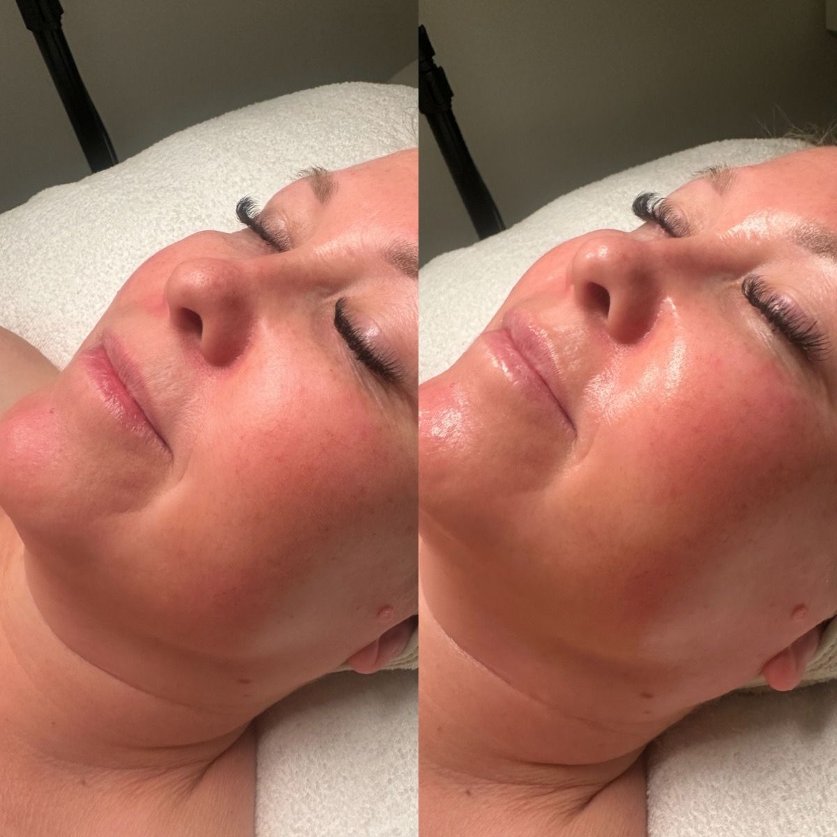 A Woman Is Laying On A Bed With Her Eyes Closed And Smiling — Vanity Skin and Beauty Forster in Forster, NSW