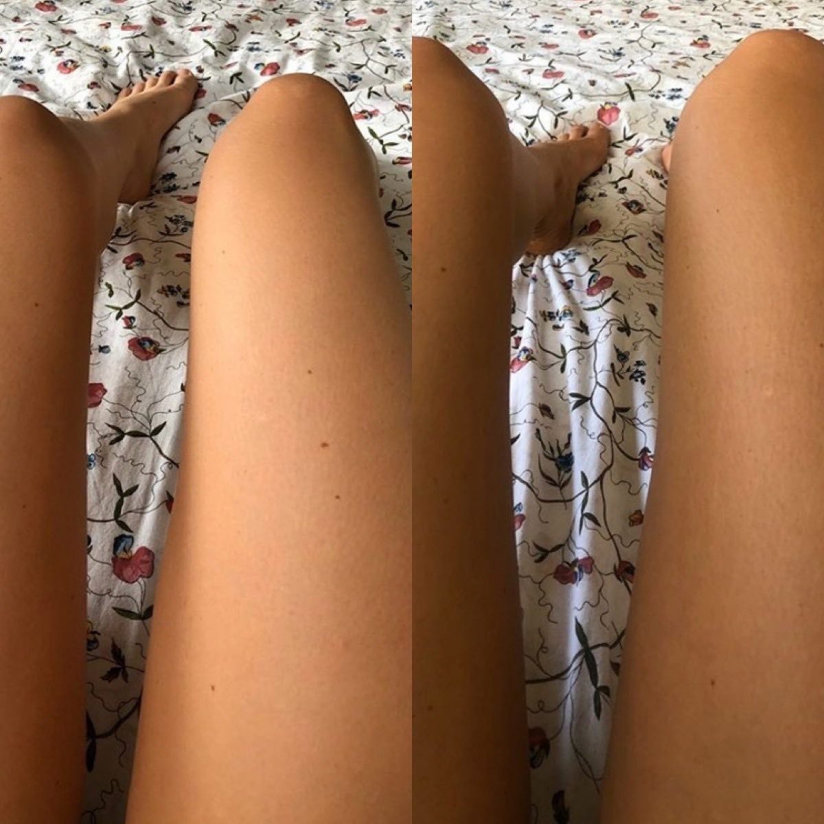 Two Legs With Tanned Skin Resting on a Floral Patterned Bedspread — Vanity Skin and Beauty Forster in Forster, NSW