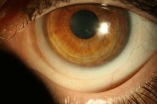 lenti a contatto a Ferrara