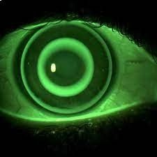 studio della cornea per lenti a contatto a Ferrara